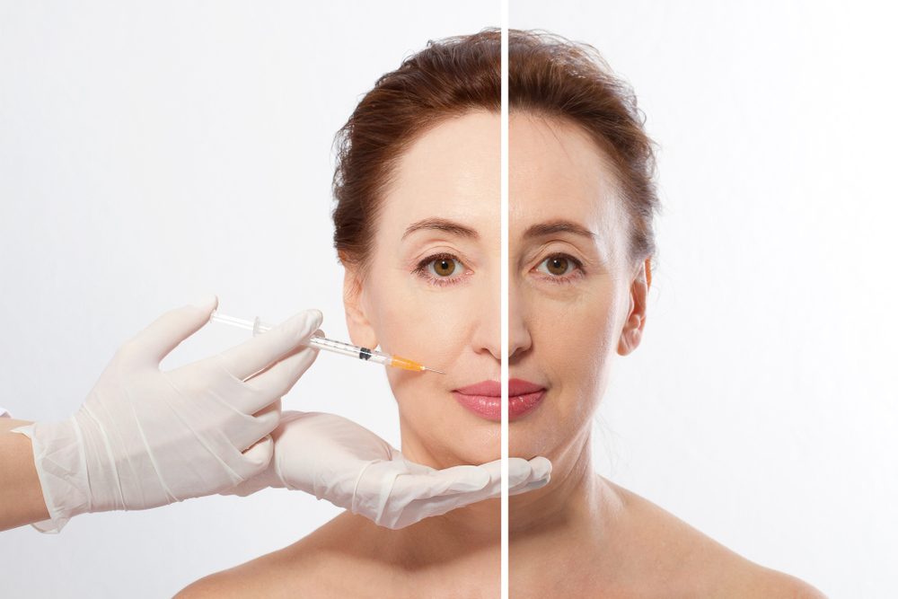 RF Skin Tightening vs. Ultrasound: What’s Best for Sagging Skin?