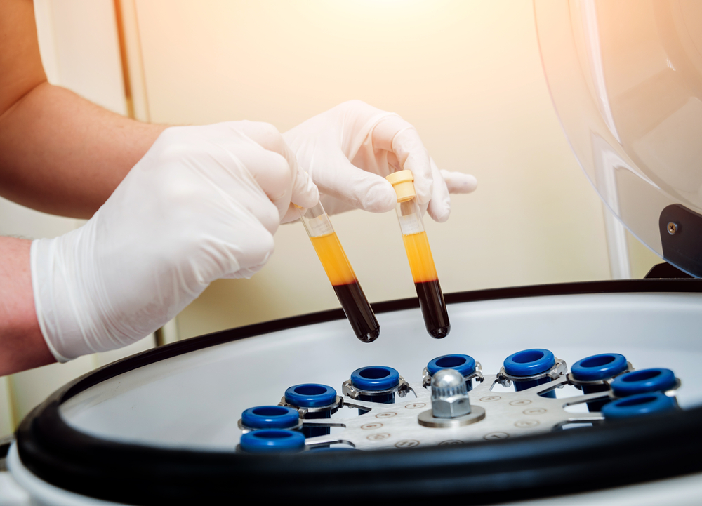 CENTRIFUGE best PRP kits n this article, we will explore some of the best PRP kits offered by RegenLab in the UK, highlighting their features, benefits, and how they contribute to the regenerative process.