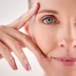 Understanding Thermage Treatment: A Non-Surgical Solution for Skin Tightening