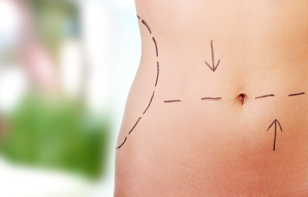 Body Contouring Surgeries and Treatments