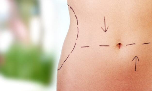 Body Contouring Surgeries and Treatments