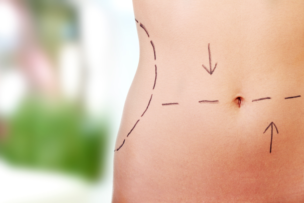 body contouring surgery and treatments