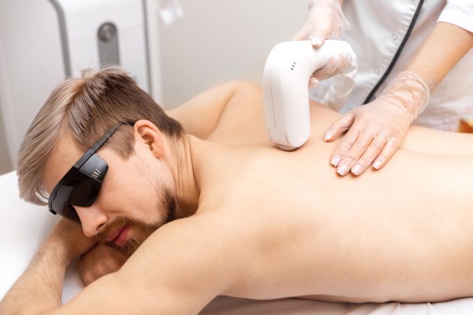 How Laser Hair Removal Is Transforming Male Grooming