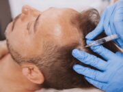 Why PRP is Still the Gold Standard for Hair Loss