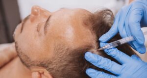 Why PRP is Still the Gold Standard for Hair Loss