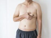 Why More Men Over 50 Are Choosing Cosmetic Surgery to Reduce ‘Moobs’