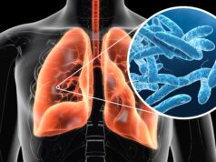A Look at Legionnaires’ Disease After UK Tourist Falls Ill in Greece