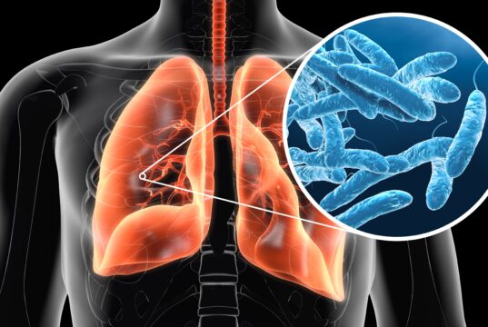 A Look at Legionnaires’ Disease After UK Tourist Falls Ill in Greece