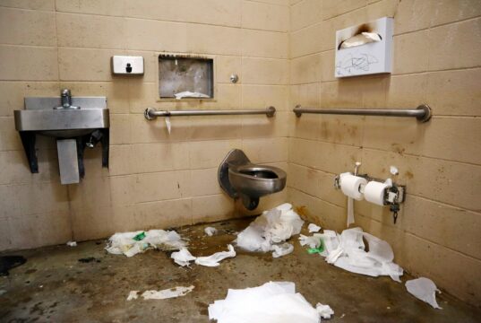 From Public Toilet Botox to Hotel‑Room Fillers: Exposing Unlicensed Cosmetic Risks and How to Stay Safe