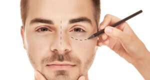 Why More Men Are Choosing Aesthetic Treatments – And What Experts Are Saying