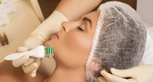 Unlock Radiant Skin: Why You Should Combine Microneedling with Polynucleotides