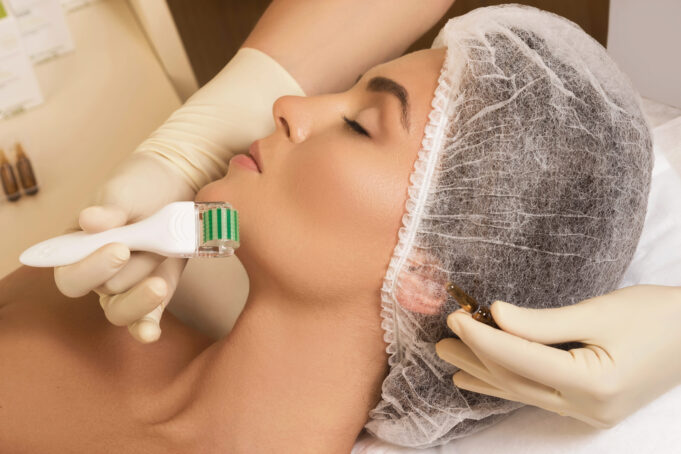 Unlock Radiant Skin: Why You Should Combine Microneedling with Polynucleotides