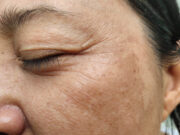 the story of wrinkles - what different wrinkles mean