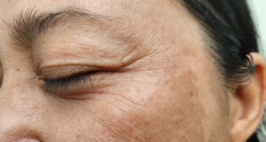 the story of wrinkles - what different wrinkles mean