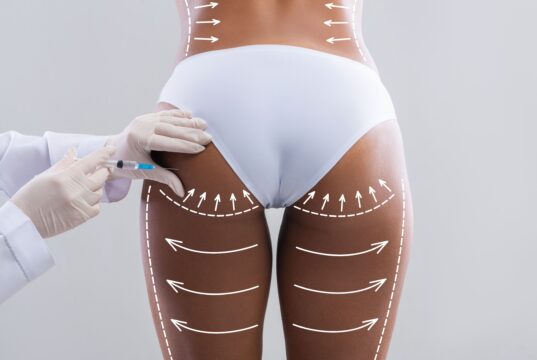 A Mother's Alarm: Urgent Reform Needed in the Face of Cosmetic “Cowboy” Procedures