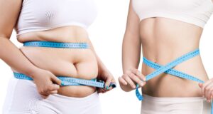 Revolutionising Obesity Care: NHS and Pharmacies Unite in £85 Million Innovation Programme