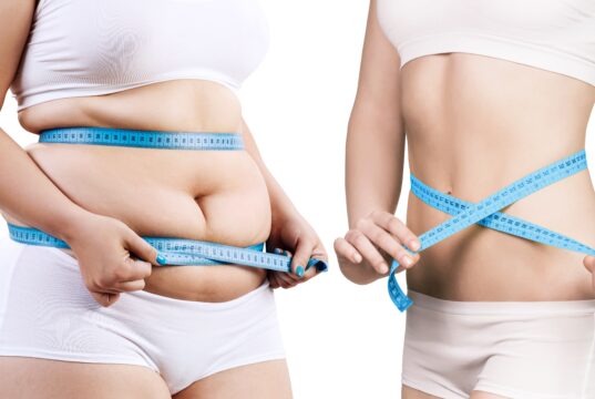 Revolutionising Obesity Care: NHS and Pharmacies Unite in £85 Million Innovation Programme