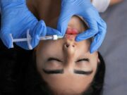 How to Maintain Filler Results Longer: Expert-Backed Tips