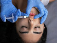 How to Maintain Filler Results Longer: Expert-Backed Tips