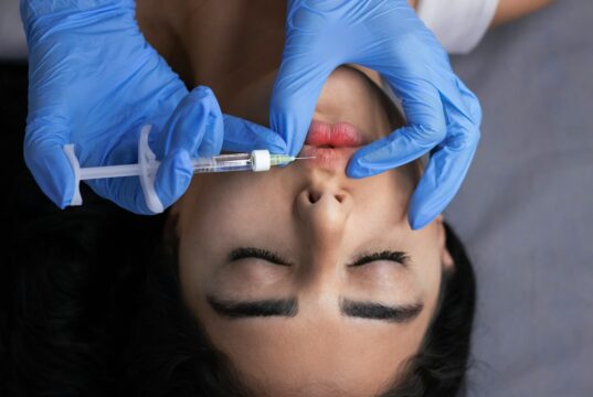 How to Maintain Filler Results Longer: Expert-Backed Tips