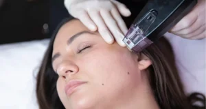 Exosome Skin Therapy