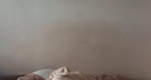 How to Repair Holiday Hangover Skin