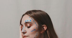 Why Thread Lifts Are the Non-Surgical Facelift of 2025