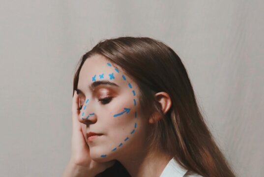 Why Thread Lifts Are the Non-Surgical Facelift of 2026 Why Thread Lifts Are the Non-Surgical Facelift of 2025