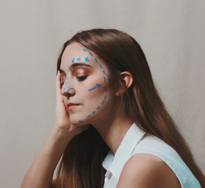 Why Thread Lifts Are the Non-Surgical Facelift of 2025