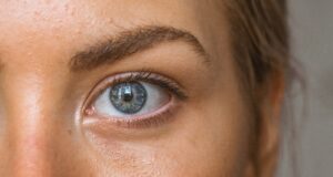 Tear-Trough Rejuvenation