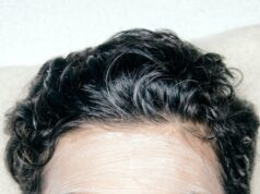 A man with a facial mask on his face