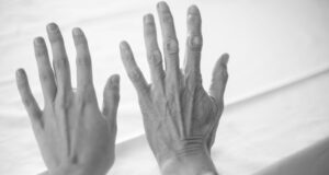 Why Ageing Well Is a Strategy, Not a Treatment