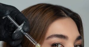 Filler Migration: Fact, Fear or Fixable?