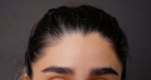 Polynucleotides Explained: The Skin Rejuvenation Treatment Everyone’s Talking About