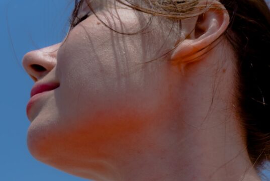 Chin Support: 2026’s Underrated Youth & Symmetry Secret