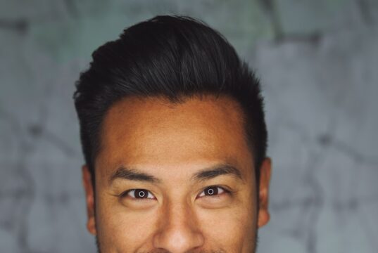 Aesthetic Burnout: Are We Doing Too Much to Our Faces?