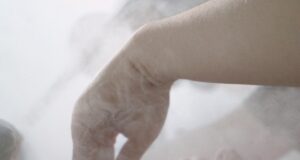 Why 2026 is the Year of Ultra-Soft, Hydrating Fillers