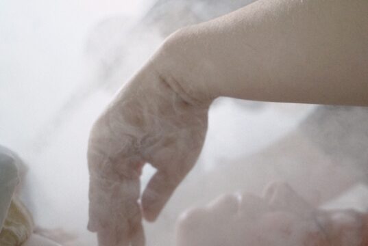 Why 2026 is the Year of Ultra-Soft, Hydrating Fillers