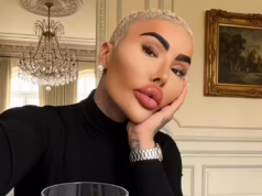 jordan parke lip king