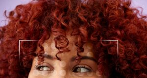 Is AI the New Dermatologist?