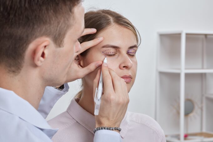 Upper Blepharoplasty: The Gen X Gateway