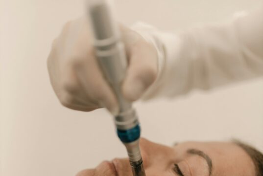 Micro-Coring: The Needle-Only Facelift Guide