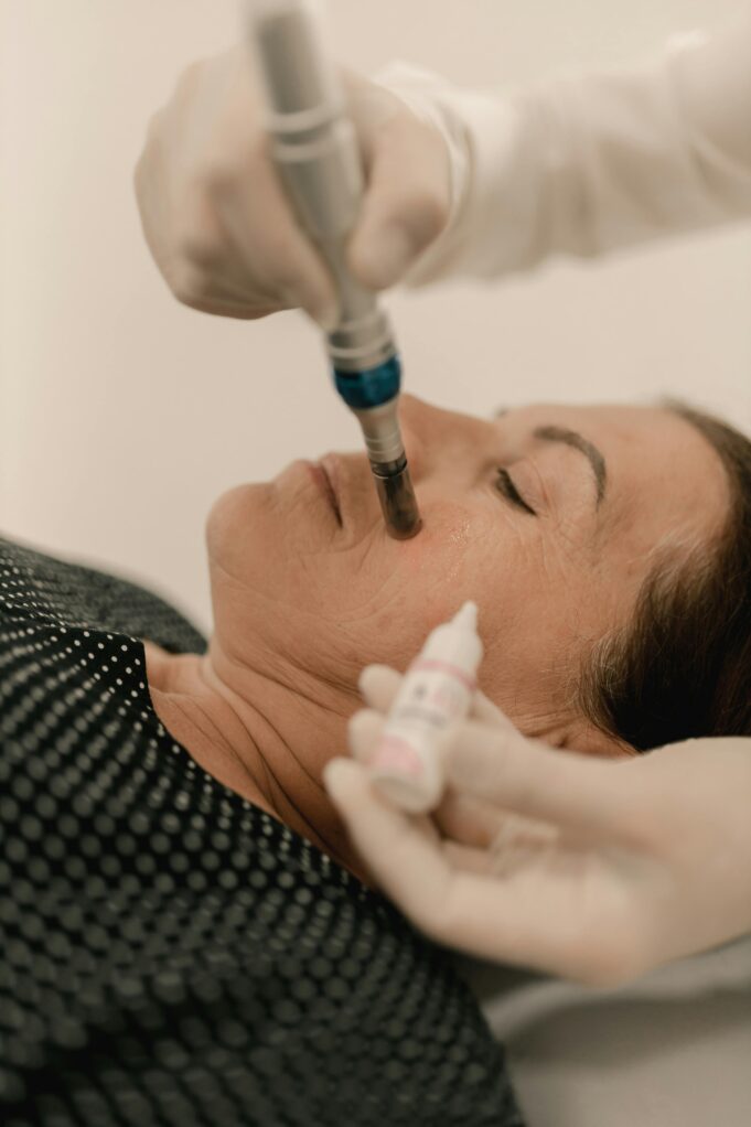 Micro-Coring: The Needle-Only Facelift Guide