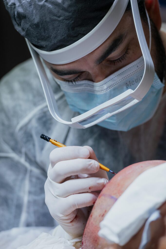 pexels-isabella-mendes-107313-21810006 Robotic Hair Transplants: Are Surgeons Now Obsolete?