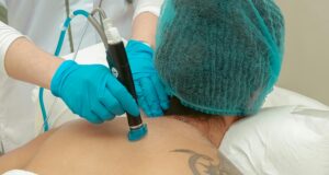 Tattoo Removal Tech: The 2025 Regret Industry Boom