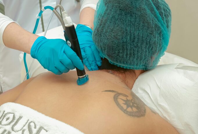 Tattoo Removal Tech: The 2025 Regret Industry Boom