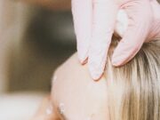 Why Treating “Just the Forehead” Backfires Why Treating "Just the Forehead" Backfires