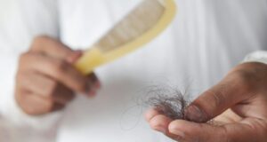 Future of Hair Loss: 3D-Printed Follicles Explained