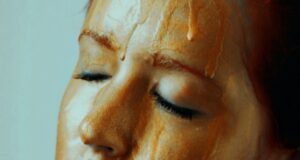 Will Heat Melt My Fillers? What to Expect From Cosmetic Treatments in High Summer