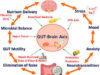 The Mind-Gut-Sex Axis: How Your Microbiome Influences Your Mood and Intimate Health The Mind-Gut-Sex Axis: How Your Microbiome Influences Your Mood and Intimate Health